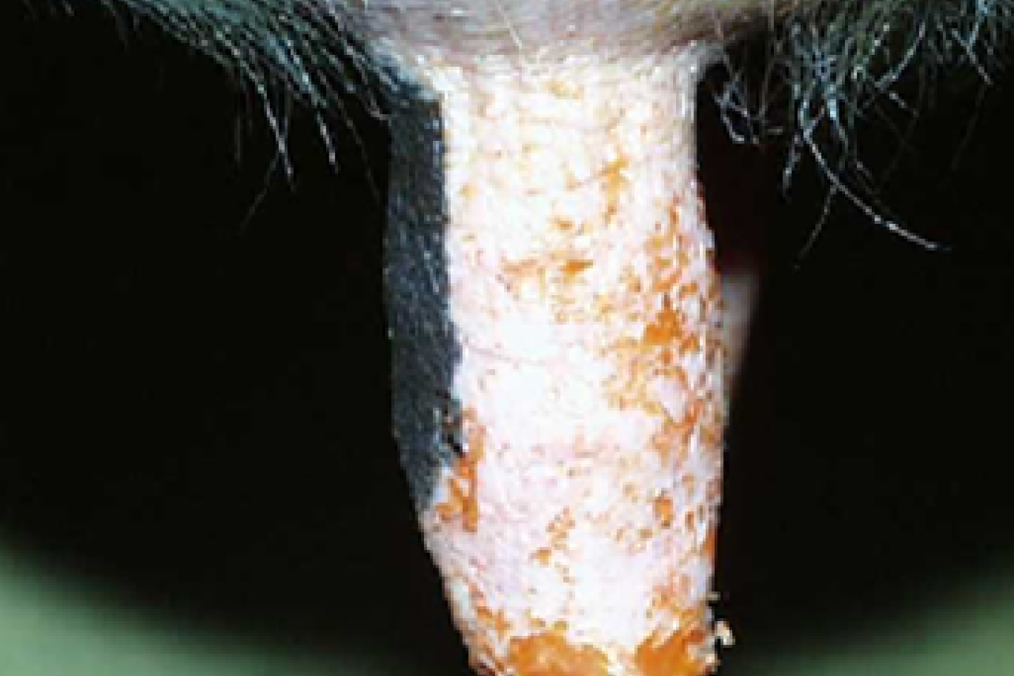 Exempel på spenskador orsakade av kemiska ämnen